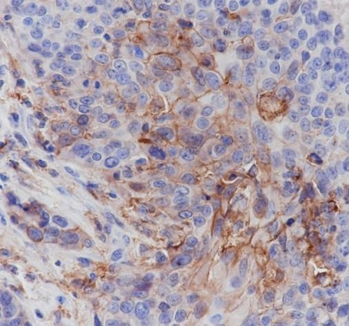 Recombinant PD-L1 Monoclonal Antibody (AGEL6551)