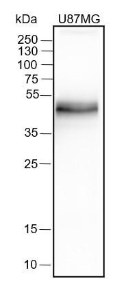 Recombinant PD-L1 Monoclonal Antibody (AGEL6551)