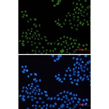 Recombinant PELP1 Monoclonal Antibody (AGEL6553)