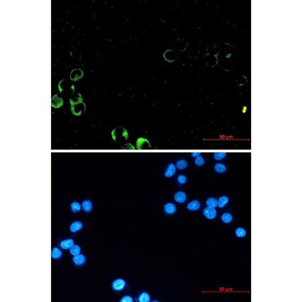 Recombinant PI3 Kinase p85 alpha Monoclonal Antibody (AGEL6557)