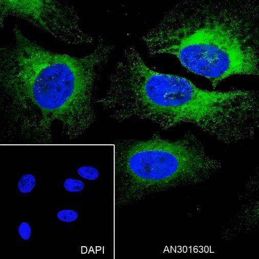 Recombinant PI3 Kinase p110 alpha Monoclonal Antibody (AGEL6558)