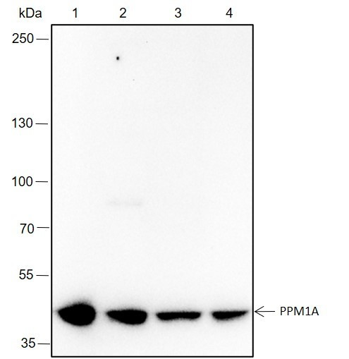 Recombinant PPM1A Monoclonal Antibody (AGEL6561)