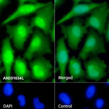 Recombinant PPP1CB Monoclonal Antibody (AGEL6562)