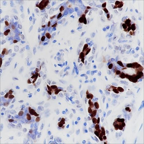 Recombinant Progesterone Receptor Monoclonal Antibody (AGEL6564)