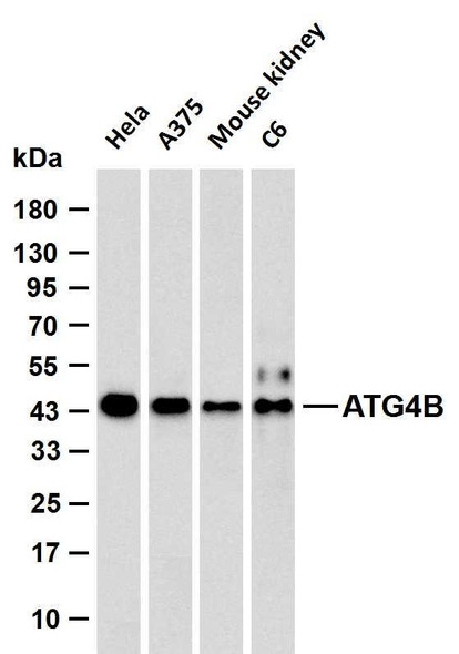 Recombinant ATG4B Monoclonal Antibody (AGEL6568)
