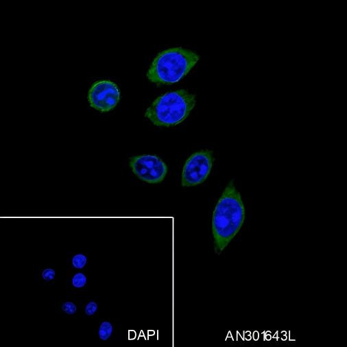 Recombinant Phospho-PTP1B (Ser386) Monoclonal Antibody (AGEL6571)
