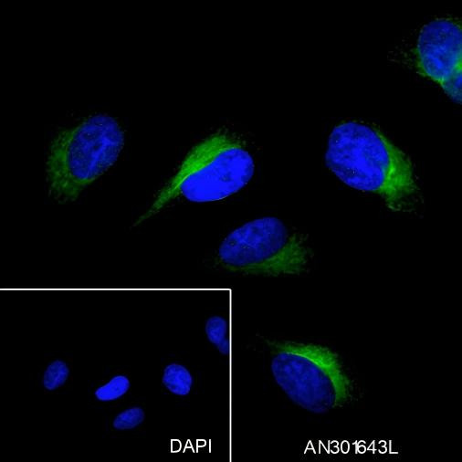 Recombinant Phospho-PTP1B (Ser386) Monoclonal Antibody (AGEL6571)