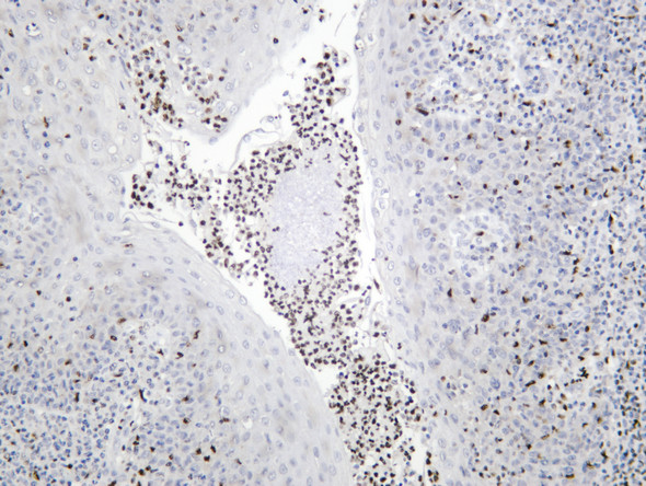 Recombinant PU.1 Monoclonal Antibody (AGEL6572)