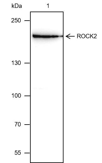 Recombinant ROCK2 Monoclonal Antibody (AGEL6577)