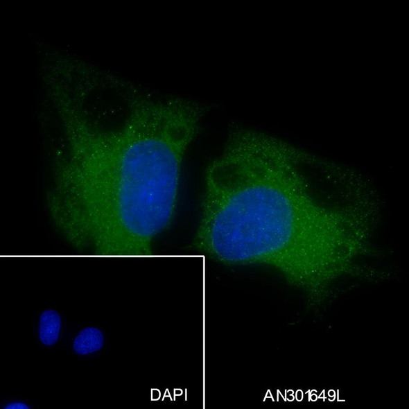 Recombinant ROCK2 Monoclonal Antibody (AGEL6577)