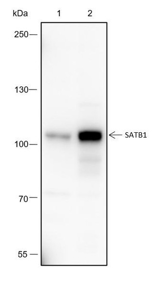 Recombinant SATB1 Monoclonal Antibody (AGEL6580)
