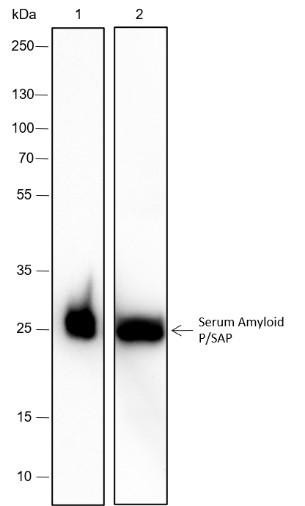 Recombinant Serum Amyloid P/SAP Monoclonal Antibody (AGEL6583)