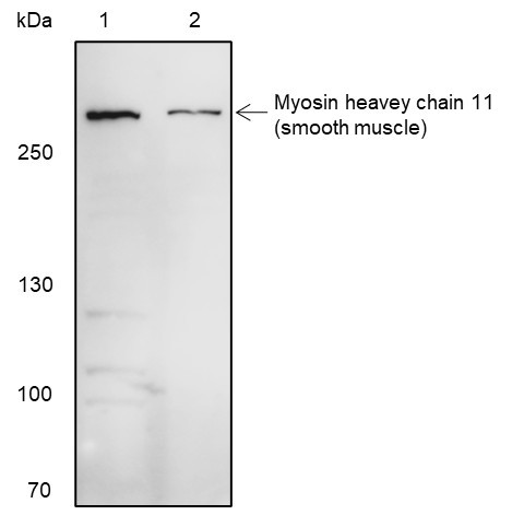 Recombinant Smooth Muscle Myosin heavy chain 11 Monoclonal Antibody (AGEL6587)