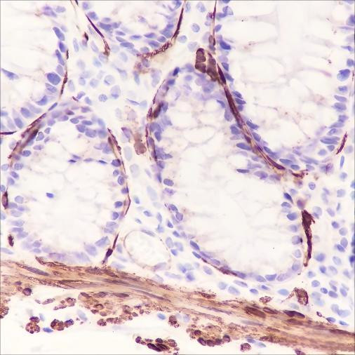 Recombinant Smooth Muscle Myosin heavy chain 11 Monoclonal Antibody (AGEL6587)