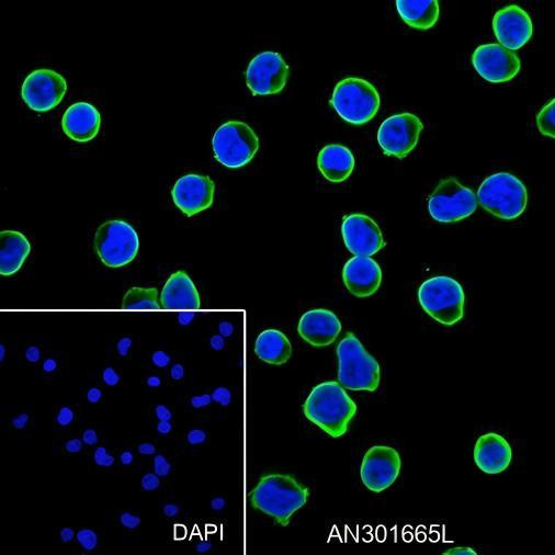 Recombinant Stathmin Monoclonal Antibody (AGEL6593)