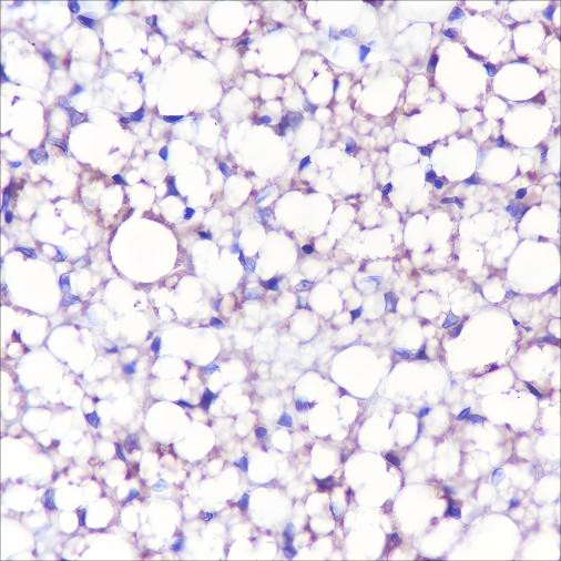 Recombinant UCP1 Monoclonal Antibody (AGEL6610)