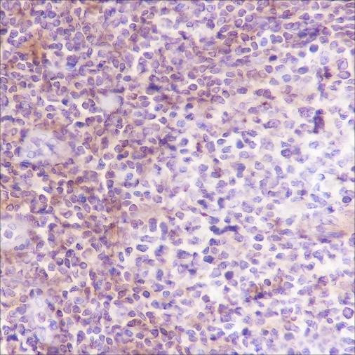 Recombinant VPAC2 Monoclonal Antibody (AGEL6616)