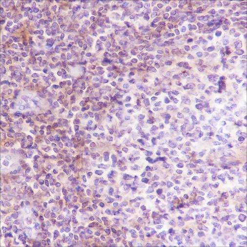 Recombinant VPAC2 Monoclonal Antibody (AGEL6616)