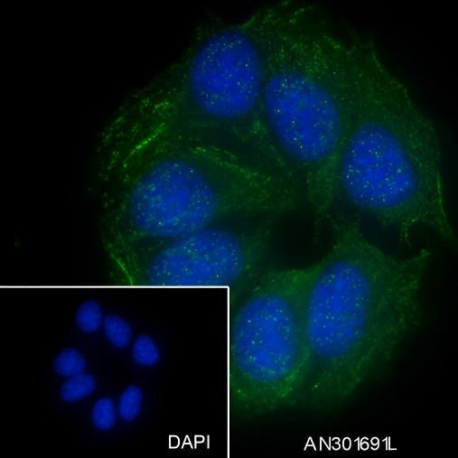 Recombinant GRP75 Monoclonal Antibody (AGEL6619)