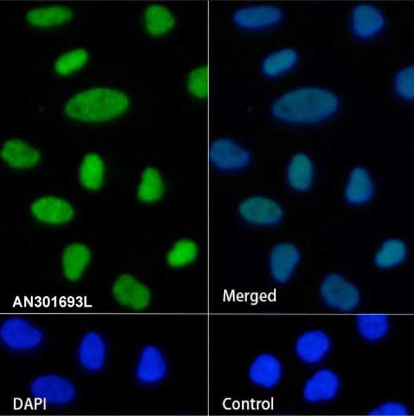 Recombinant KDM2A Monoclonal Antibody (AGEL6621)