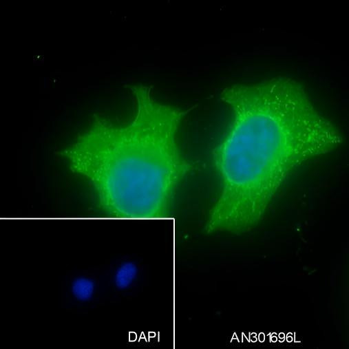 Recombinant IRF6 Monoclonal Antibody (AGEL6624)