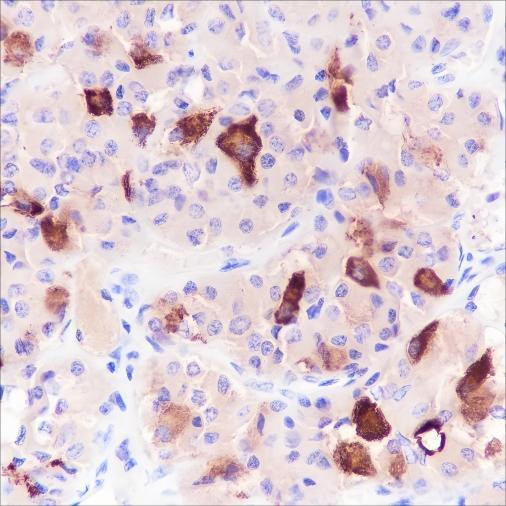 Recombinant FSH beta Monoclonal Antibody (AGEL6627)