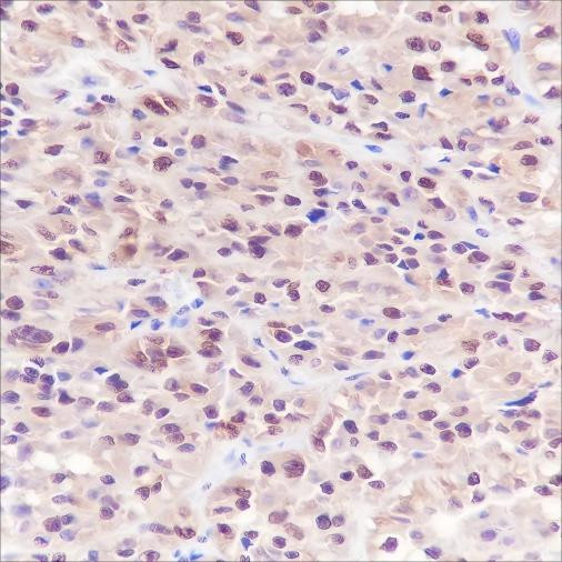 Recombinant S100A1 Monoclonal Antibody (AGEL6634)