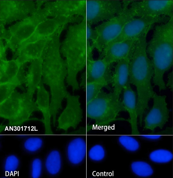 Recombinant Na+/K+ ATPase alpha-1 Monoclonal Antibody (AGEL6639)