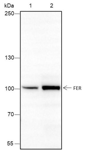 Recombinant FER Monoclonal Antibody (AGEL6640)
