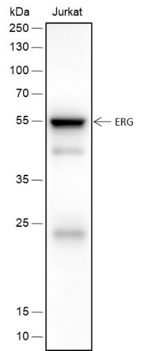 Recombinant ERG Monoclonal Antibody (AGEL6642)