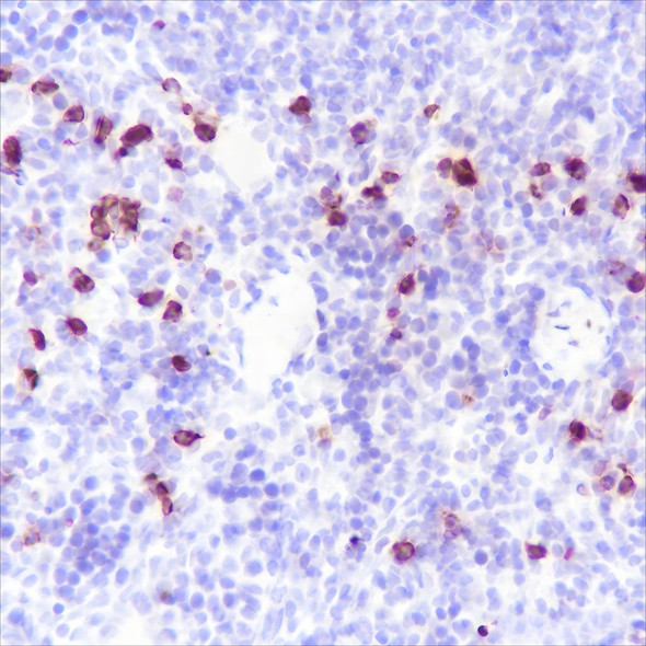Recombinant S100A8 Monoclonal Antibody (AGEL6646)