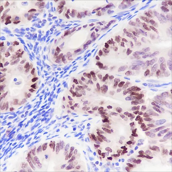 Recombinant BAF60C Monoclonal Antibody (AGEL6650)