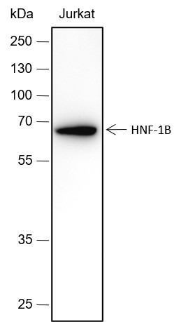Recombinant HNF-1B Monoclonal Antibody (AGEL6653)