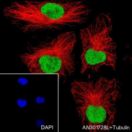 Recombinant DNMT1 Monoclonal Antibody (AGEL6655)