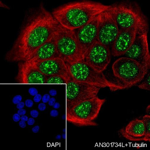 Recombinant HMGA1 Monoclonal Antibody (AGEL6661)