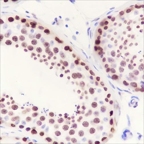 Recombinant HMGA1 Monoclonal Antibody (AGEL6661)