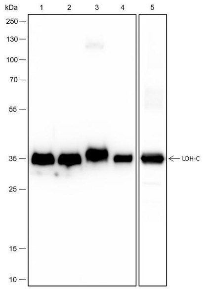 Recombinant LDHC Monoclonal Antibody (AGEL6662)