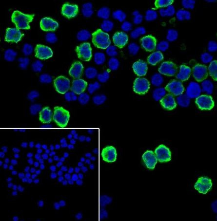 Recombinant S100A9 Monoclonal Antibody (AGEL6669)