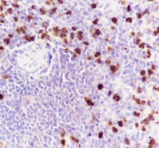 Recombinant S100A9 Monoclonal Antibody (AGEL6669)