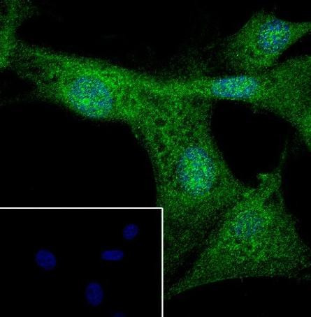 Recombinant BRN3A Monoclonal Antibody (AGEL6676)