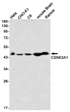 Recombinant CSNK2A1 Monoclonal Antibody (AGEL6681)