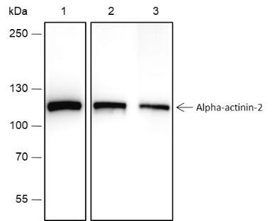 Recombinant alpha Actinin 2 Monoclonal Antibody (AGEL6682)