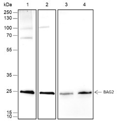 Recombinant BAG2 Monoclonal Antibody (AGEL6684)