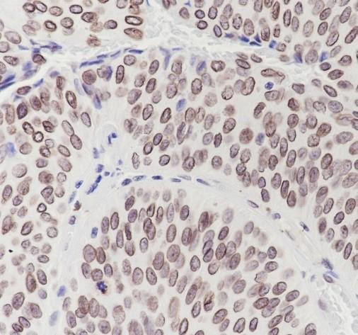 Recombinant Lamin B2 Monoclonal Antibody (AGEL6690)