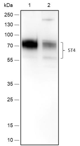 Recombinant 5T4 Monoclonal Antibody (AGEL6692)