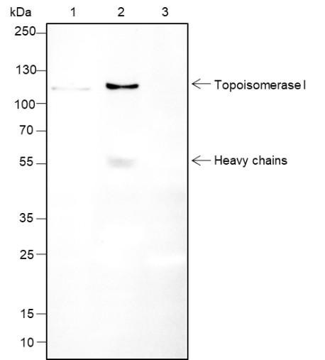 Recombinant Topoisomerase I Monoclonal Antibody (AGEL6694)