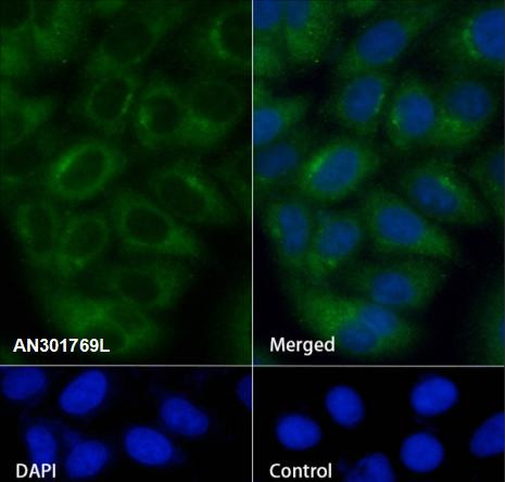 Recombinant MUC13 Monoclonal Antibody (AGEL6696)