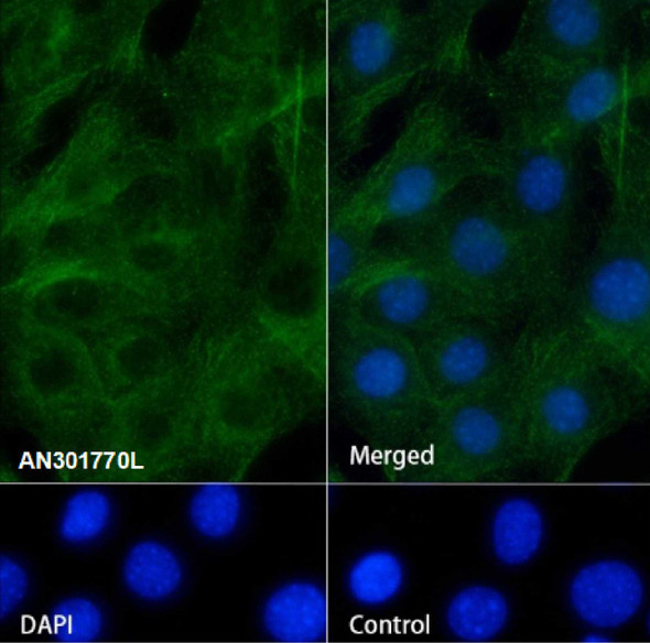 Recombinant ELP4 Monoclonal Antibody (AGEL6697)