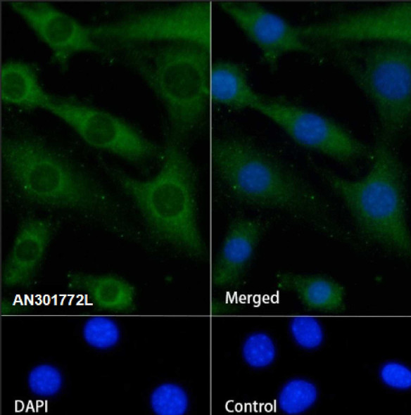 Recombinant RPL26L1 Monoclonal Antibody (AGEL6699)