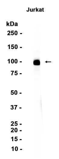Recombinant CD6/T12 Monoclonal Antibody (AGEL6704)